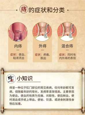 孕期外痔(孕期长痔疮怎么治疗) 第2张 孕期外痔(孕期长痔疮怎么治疗) 第2张