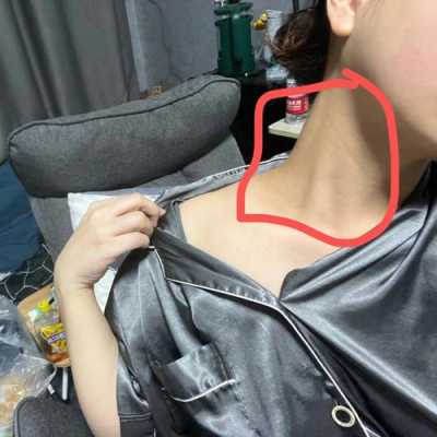 孕期脖子疼(孕期脖子变黑怎么办) 第1张 孕期脖子疼(孕期脖子变黑怎么办) 第1张