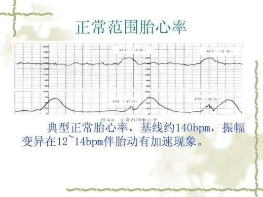 胎儿生物物理监测(孕22周胎动减少是怎么回事) 第2张 胎儿生物物理监测(孕22周胎动减少是怎么回事) 第2张