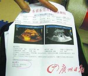 怎样看胎儿体重(怎样看胎儿体重b超单) 第2张 怎样看胎儿体重(怎样看胎儿体重b超单) 第2张