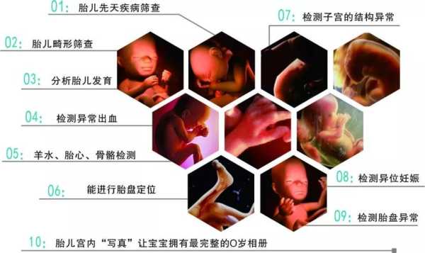 孕期四维彩超(孕期四维彩超几周做最佳时间) 第1张 孕期四维彩超(孕期四维彩超几周做最佳时间) 第1张