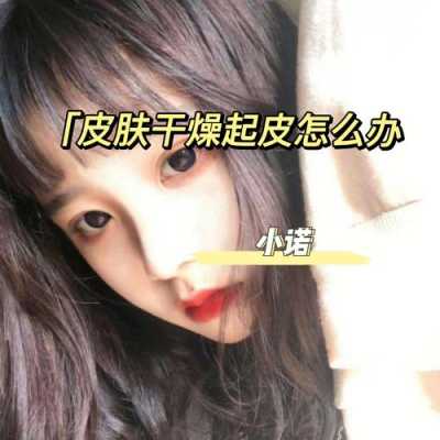 孕期脸干怎么办,孕期皮肤干燥起皮屑怎么办 第2张 孕期脸干怎么办,孕期皮肤干燥起皮屑怎么办 第2张
