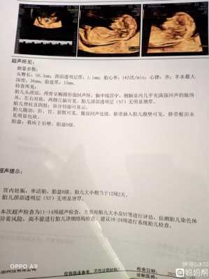 胎儿心率高是女孩吗(胎儿心率高是女孩吗?) 第2张 胎儿心率高是女孩吗(胎儿心率高是女孩吗?) 第2张
