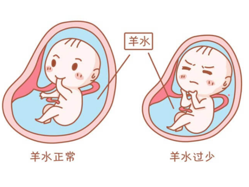 羊水少胎儿缺氧的表现(羊水少胎儿缺氧的表现与症状) 第1张 羊水少胎儿缺氧的表现(羊水少胎儿缺氧的表现与症状) 第1张