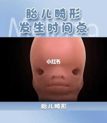 睡觉会把胎儿压畸形吗(胎儿会跟着母亲熬夜吗) 第2张 睡觉会把胎儿压畸形吗(胎儿会跟着母亲熬夜吗) 第2张