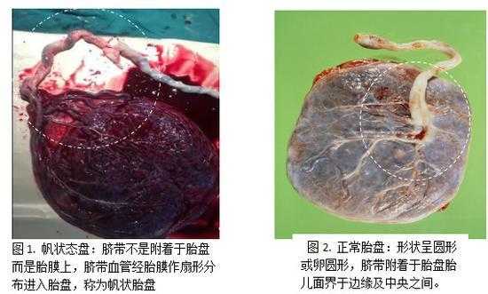 怀孕多久开始长胎盘,胎儿几个月有胎盘和脐带 第2张 怀孕多久开始长胎盘,胎儿几个月有胎盘和脐带 第2张