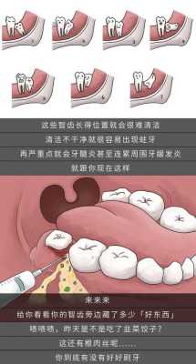 孕期智齿疼(孕期智齿疼痛难忍怎么办) 第2张 孕期智齿疼(孕期智齿疼痛难忍怎么办) 第2张