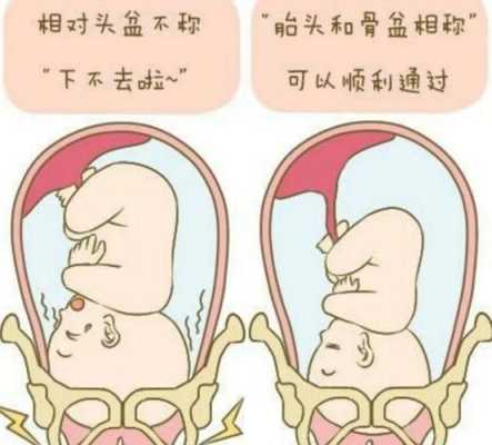 胎儿没入盆可以顺产吗(胎儿没入盆可以顺产吗?) 第2张 胎儿没入盆可以顺产吗(胎儿没入盆可以顺产吗?) 第2张