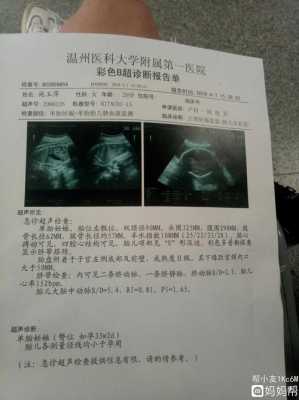 胎儿偏小3周问题大吗(胎儿偏小3周问题大吗正常吗) 第1张 胎儿偏小3周问题大吗(胎儿偏小3周问题大吗正常吗) 第1张