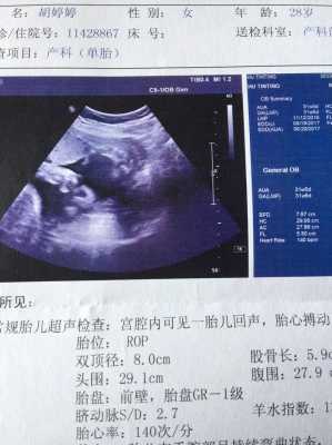 胎儿偏小3周问题大吗(胎儿偏小3周问题大吗正常吗) 第2张 胎儿偏小3周问题大吗(胎儿偏小3周问题大吗正常吗) 第2张