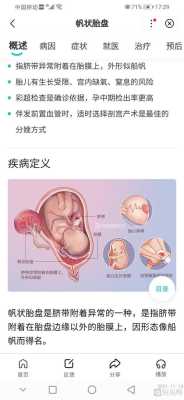帆状胎盘的胎儿能要吗(帆状胎盘对胎儿有影响吗) 第2张 帆状胎盘的胎儿能要吗(帆状胎盘对胎儿有影响吗) 第2张