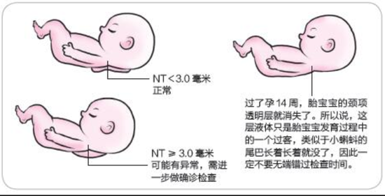 nt增厚胎儿正常的概率(nt增厚羊穿容易过吗) 第3张 nt增厚胎儿正常的概率(nt增厚羊穿容易过吗) 第3张
