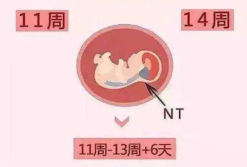 nt增厚胎儿正常的概率(nt增厚羊穿容易过吗) 第1张 nt增厚胎儿正常的概率(nt增厚羊穿容易过吗) 第1张