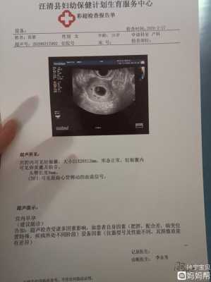 胎心偏低会影响胎儿吗(有胎芽胎心孕酮低没事吗) 第2张 胎心偏低会影响胎儿吗(有胎芽胎心孕酮低没事吗) 第2张