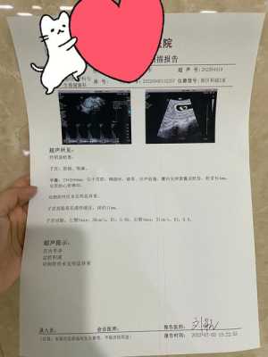 胎心偏低会影响胎儿吗(有胎芽胎心孕酮低没事吗) 第1张 胎心偏低会影响胎儿吗(有胎芽胎心孕酮低没事吗) 第1张