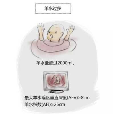 羊水多怎么回事,胎儿羊水多是什么原因造成的 第2张 羊水多怎么回事,胎儿羊水多是什么原因造成的 第2张