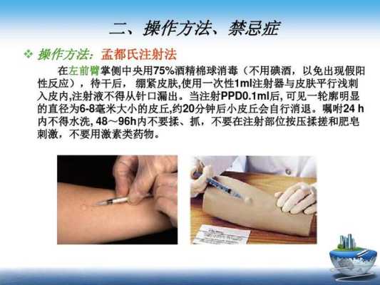 怀孕期间能做吗（结核菌素试验怀孕期间能做吗）  第2张