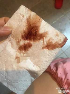 孕期出血图片(孕期出血图片真实) 第1张 孕期出血图片(孕期出血图片真实) 第1张