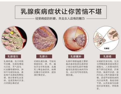 孕期乳腺增生（乳腺增生样改变是什么意思）  第1张