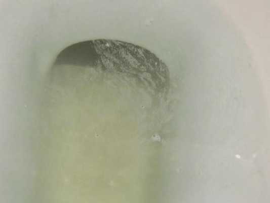 怀孕期间白带发黄对宝宝有影响吗,孕妇尿完尿一擦黄绿色分泌物 第1张 怀孕期间白带发黄对宝宝有影响吗,孕妇尿完尿一擦黄绿色分泌物 第1张