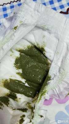 怀孕后大便绿色怎么回事,孕期大便绿色是什么原因 第3张 怀孕后大便绿色怎么回事,孕期大便绿色是什么原因 第3张