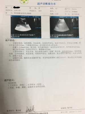 胎儿肾积水20mm严重吗(胎儿肾积水20mm严重吗怎么治疗) 第1张 胎儿肾积水20mm严重吗(胎儿肾积水20mm严重吗怎么治疗) 第1张