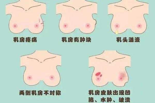 乳头结痂怎么回事,孕期乳头结痂能去掉吗 第1张 乳头结痂怎么回事,孕期乳头结痂能去掉吗 第1张