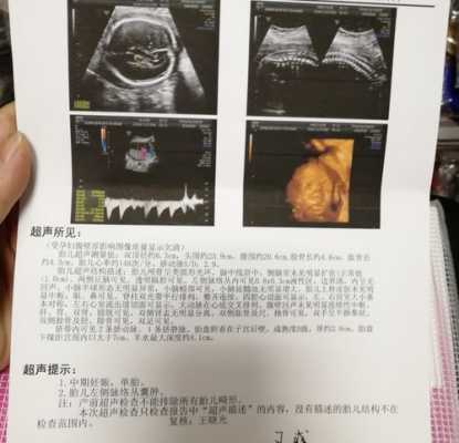 我家孩子43天做了一个脑部彩超。左侧脉络丛小囊肿,怎么办,胎儿左下腹囊肿怎么办啊 第2张 我家孩子43天做了一个脑部彩超。左侧脉络丛小囊肿,怎么办,胎儿左下腹囊肿怎么办啊 第2张