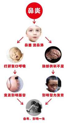 鼻窦炎对胎儿有影响吗(鼻窦炎对胎儿有影响吗) 第1张 鼻窦炎对胎儿有影响吗(鼻窦炎对胎儿有影响吗) 第1张