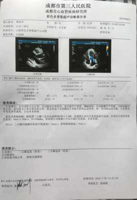 孕妇心脏彩超多少钱,为什么不建议做心脏彩超 第2张 孕妇心脏彩超多少钱,为什么不建议做心脏彩超 第2张
