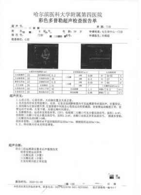 孕妇心脏彩超多少钱,为什么不建议做心脏彩超 第1张 孕妇心脏彩超多少钱,为什么不建议做心脏彩超 第1张