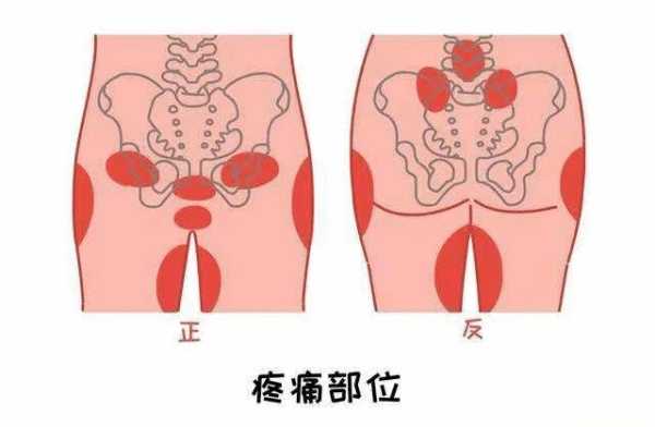 孕期大腿根疼(孕期大腿根疼是什么原因) 第1张 孕期大腿根疼(孕期大腿根疼是什么原因) 第1张