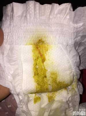 怀孕37周大便带血对胎儿有影响吗,孕妇大便出血要检查吗 第2张 怀孕37周大便带血对胎儿有影响吗,孕妇大便出血要检查吗 第2张