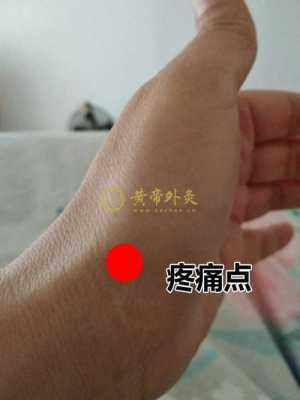 孕期手腕疼(孕期手腕疼是什么原因) 第1张 孕期手腕疼(孕期手腕疼是什么原因) 第1张