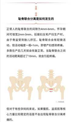孕期耻骨分离怎么办,孕期耻骨分离生完可以恢复吗 第1张 孕期耻骨分离怎么办,孕期耻骨分离生完可以恢复吗 第1张