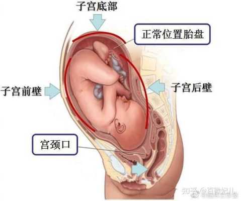 着床于前壁及后壁啥意思,前壁和后壁哪个顺产快 第1张 着床于前壁及后壁啥意思,前壁和后壁哪个顺产快 第1张