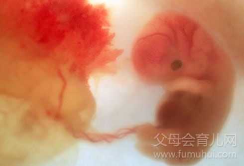 两个月的胎儿有灵魂吗(两个月的胎儿有灵魂吗图片) 第3张 两个月的胎儿有灵魂吗(两个月的胎儿有灵魂吗图片) 第3张