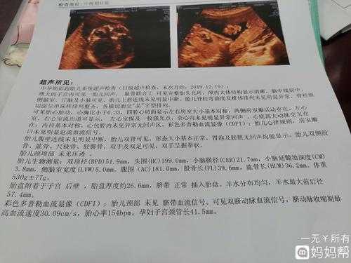 胎儿左右心室有强光点怎么办(胎儿左右心室有强光点怎么办33周) 第1张 胎儿左右心室有强光点怎么办(胎儿左右心室有强光点怎么办33周) 第1张