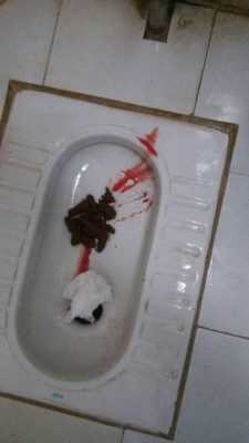 孕期有点出血(孕妇大便有血正常吗) 第2张 孕期有点出血(孕妇大便有血正常吗) 第2张