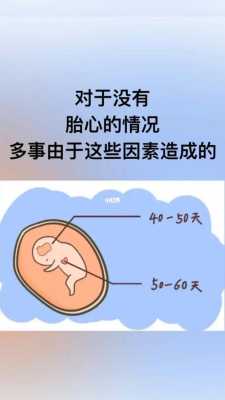 怀孕孩子没有胎心怎么回事,胎儿没胎心是什么原因造成的怎么办 第1张 怀孕孩子没有胎心怎么回事,胎儿没胎心是什么原因造成的怎么办 第1张
