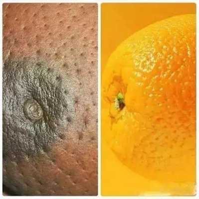 孕期乳头变黑(孕期乳头变黑了还会变回来吗?) 第1张 孕期乳头变黑(孕期乳头变黑了还会变回来吗?) 第1张