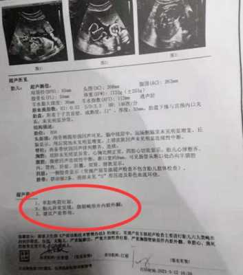儿童没上户口如何查看核酸结果,检查胎儿是否畸形做什么检查 第2张 儿童没上户口如何查看核酸结果,检查胎儿是否畸形做什么检查 第2张