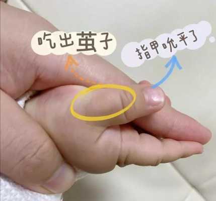 19个月宝宝习惯吃手指,要怎样纠正啊,经常把手指给吮破了,吃胎儿事件是真的吗 第1张 19个月宝宝习惯吃手指,要怎样纠正啊,经常把手指给吮破了,吃胎儿事件是真的吗 第1张