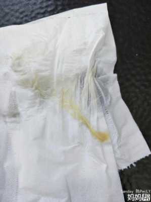 孕期黄色白带 第2张 孕期黄色白带 第2张