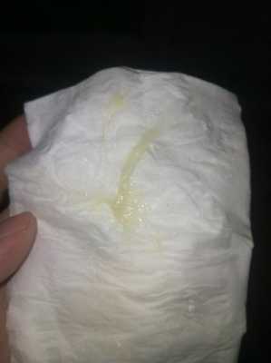 孕期黄色白带 第1张 孕期黄色白带 第1张
