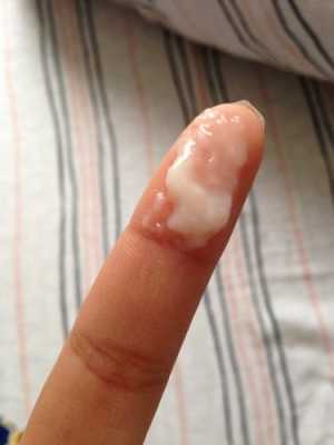 孕期白带异味(流产后白带有异味怎么办) 第2张 孕期白带异味(流产后白带有异味怎么办) 第2张