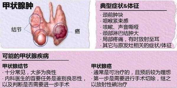 孕期甲状腺结节(孕期甲状腺结节对胎儿有影响吗) 第2张 孕期甲状腺结节(孕期甲状腺结节对胎儿有影响吗) 第2张