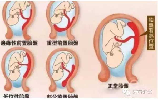 胎儿胎盘(胎儿胎盘什么时候长出来) 第3张 胎儿胎盘(胎儿胎盘什么时候长出来) 第3张