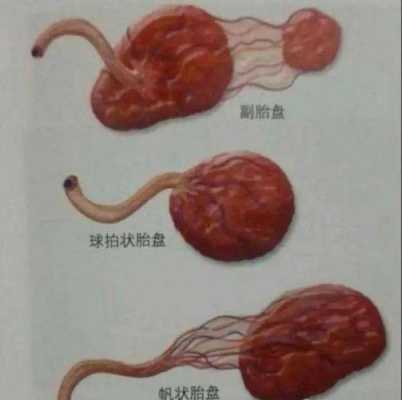 胎儿胎盘(胎儿胎盘什么时候长出来) 第2张 胎儿胎盘(胎儿胎盘什么时候长出来) 第2张