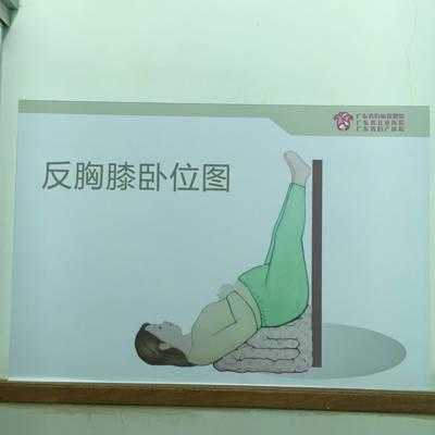 胎儿33周(孕33周胎儿臀位,要怎么办) 第3张 胎儿33周(孕33周胎儿臀位,要怎么办) 第3张